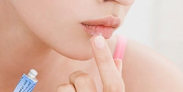 Симптомы и лечение ожога на губе
