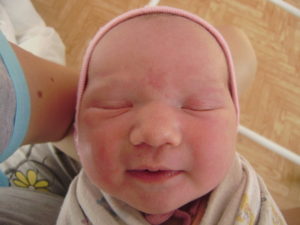 Почему появилось красное пятно на лбу у новорожденного?,Post navigation