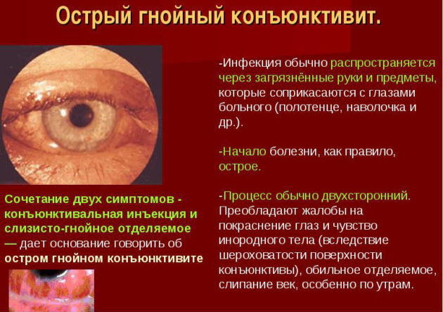 Острая форма гнойной глазной инфекции
