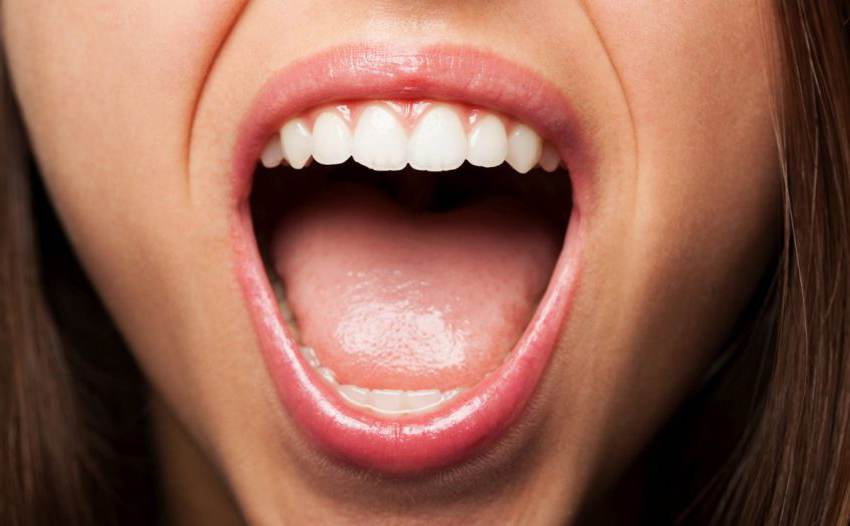 Женщина открывает рот, чтобы показать оральный микоз