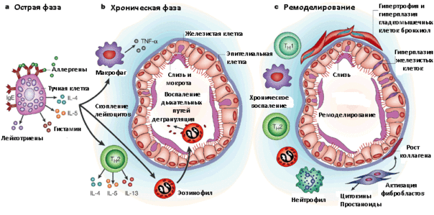 Патогенез бронхиальной астмы
