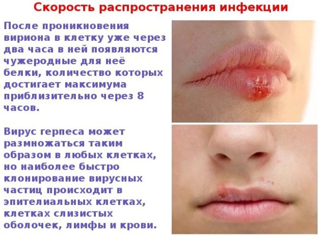 Инфекционные заболевания губ