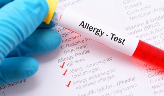 Что нужно знать об анализе на аллергены