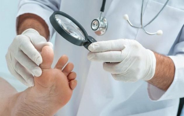Чем опасен дерматит на ногах и как его лечить
