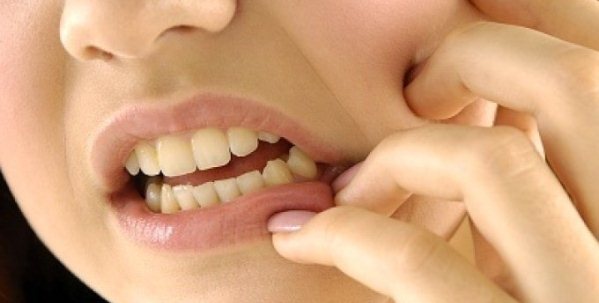 Причины появления и особенности лечения мозоли во рту