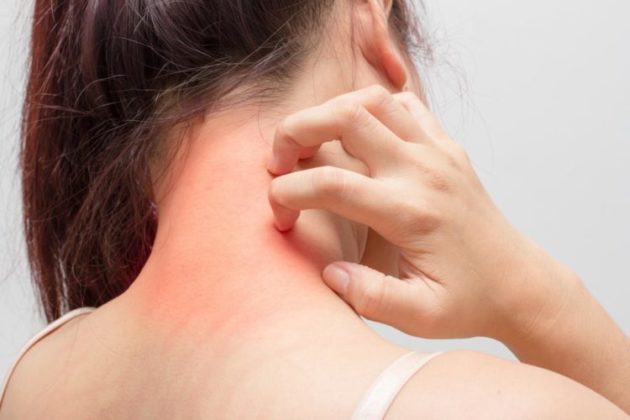 Аллергия на коже, красные пятна, клиническая картина и лечение