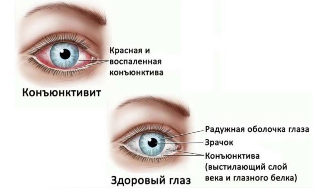 Конъюнктивы глаз