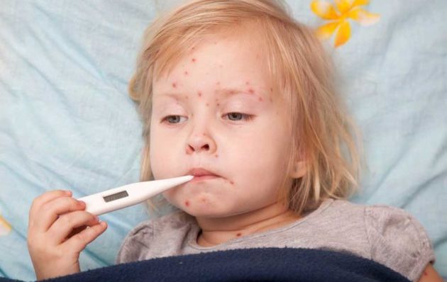 Признаки аллергии у детей
