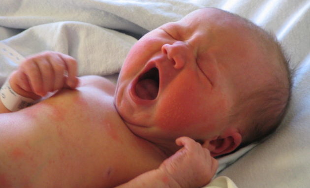 Пищевая аллергия у новорожденных